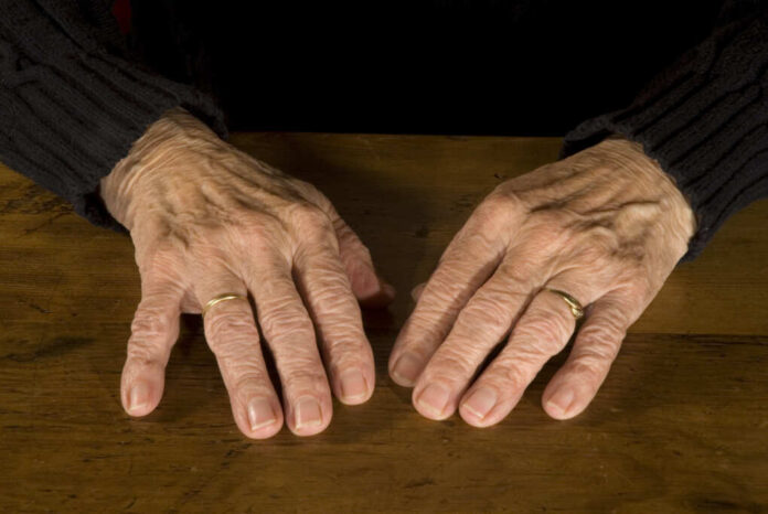 Resting,Old,Hands