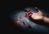 A hand lying on a surface with blood splatters around it